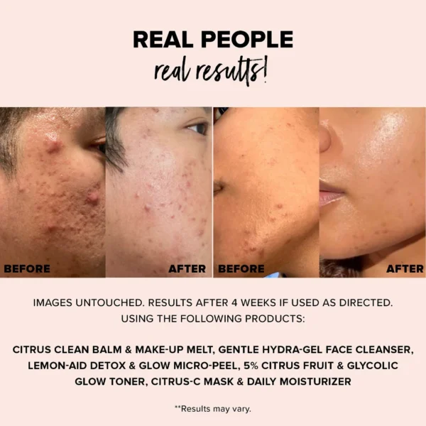 NUDESKIN Lemon-Aid Detox & Glow Micro-Peel - Image 2
